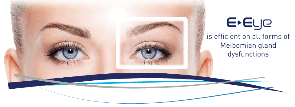 جدید ترین درمان خشکی چشم
